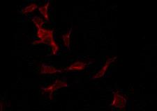 TLE2 Antibody - Staining LOVO cells by IF/ICC. The samples were fixed with PFA and permeabilized in 0.1% Triton X-100, then blocked in 10% serum for 45 min at 25°C. The primary antibody was diluted at 1:200 and incubated with the sample for 1 hour at 37°C. An Alexa Fluor 594 conjugated goat anti-rabbit IgG (H+L) Ab, diluted at 1/600, was used as the secondary antibody.
