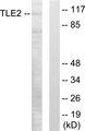 TLE2 Antibody - Western blot analysis of extracts from LOVO cells, using TLE2 antibody.