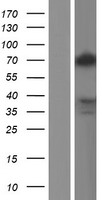 TLE2 Protein - Western validation with an anti-DDK antibody * L: Control HEK293 lysate R: Over-expression lysate