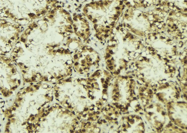 TLE3 Antibody - 1:100 staining human lung tissue by IHC-P. The sample was formaldehyde fixed and a heat mediated antigen retrieval step in citrate buffer was performed. The sample was then blocked and incubated with the antibody for 1.5 hours at 22°C. An HRP conjugated goat anti-rabbit antibody was used as the secondary.