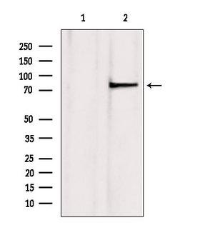 TLE3 Antibody - Western blot analysis of extracts of mouse brain tissue using TLE3 antibody. Lane 1 was treated with the blocking peptide.