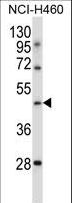 TLE6 Antibody - TLE6 Antibody (N-term ) western blot of NCI-H460 cell line lysates (35 ug/lane). The TLE6 antibody detected the TLE6 protein (arrow).