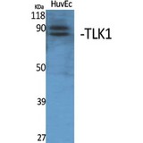 TLK1 Antibody - Western blot of TLK1 antibody