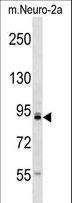 TLK1 Antibody - Mouse Tlk1 Antibody western blot of mouse Neuro-2a cell line lysates (35 ug/lane). The Tlk1 antibody detected the Tlk1 protein (arrow).