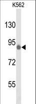 TLK1 Antibody - Western blot of hTLK1-L687 in K562 cell line lysates (35 ug/lane). TLK1 (arrow) was detected using the purified antibody.