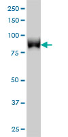 TLK1 Antibody - TLK1 monoclonal antibody (M01), clone 4B3 Western blot of TLK1 expression in HeLa NE.