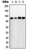 TLK1 Antibody - Western blot analysis of TLK1 expression in HeLa (A); A431 (B); NIH3T3 (C); rat thymus (D) whole cell lysates.