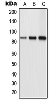 TLK1 Antibody - Western blot analysis of TLK1 expression in HeLa (A); NIH3T3 (B); PC12 (C) whole cell lysates.