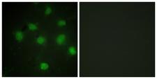 TLK1 Antibody - Peptide - + Immunofluorescence analysis of COS7 cells, using TLK1 antibody.