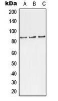 TLK1 Antibody - Western blot analysis of TLK1 (pS743) expression in MCF7 (A); rat brain (B); H9C2 (C) whole cell lysates.