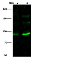 TLK1 Antibody - Anti-TLK1 rabbit polyclonal antibody at 1:500 dilution. Lane A: 293T Whole Cell Lysate. Lane B: K562 Whole Cell Lysate. Lysates/proteins at 30 ug per lane. Secondary: Goat Anti-Rabbit IgG H&L (Dylight 800) at 1/10000 dilution. Developed using the Odyssey technique. Performed under reducing conditions. Predicted band size: 87 kDa. Observed band size: 87 kDa. (We are unsure as to the identity of these extra bands.)