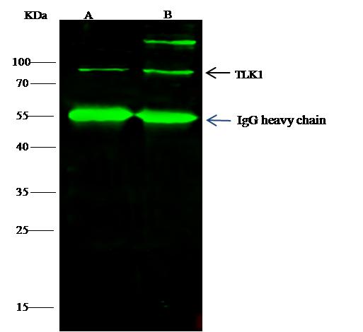TLK1 Antibody - TLK1 was immunoprecipitated using: Lane A: 0.5 mg 293T Whole Cell Lysate. Lane B: 0.5 mg K562 Whole Cell Lysate. 4 uL anti-TLK1 rabbit polyclonal antibody and 60 ug of Immunomagnetic beads Protein G. Primary antibody: Anti-TLK1 rabbit polyclonal antibody, at 1:100 dilution. Secondary antibody: Dylight 800-labeled antibody to rabbit IgG (H+L), at 1:5000 dilution. Developed using the odssey technique. Performed under reducing conditions. Predicted band size: 87 kDa. Observed band size: 87 kDa.