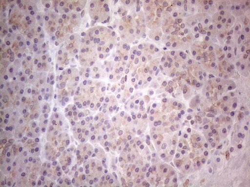 TLK2 Antibody - Immunohistochemical staining of paraffin-embedded Human pancreas tissue within the normal limits using anti-TLK2 mouse monoclonal antibody. (Heat-induced epitope retrieval by 1mM EDTA in 10mM Tris buffer. (pH8.5) at 120°C for 3 min. (1:150)