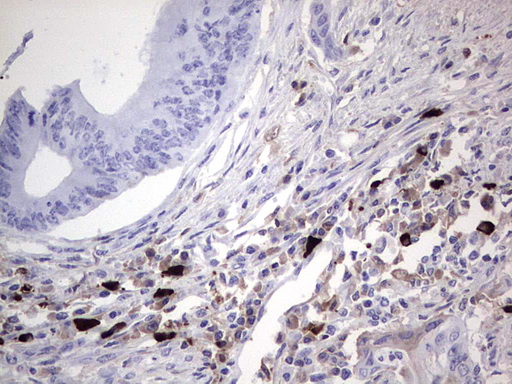 TLK2 Antibody - Immunohistochemical staining of paraffin-embedded Human colon tissue within the normal limits using anti-TLK2 mouse monoclonal antibody. (Heat-induced epitope retrieval by 1 mM EDTA in 10mM Tris, pH8.5, 120C for 3min,