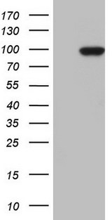 TLK2 Antibody - HEK293T cells were transfected with the pCMV6-ENTRY control (Left lane) or pCMV6-ENTRY TLK2 (Right lane) cDNA for 48 hrs and lysed. Equivalent amounts of cell lysates (5 ug per lane) were separated by SDS-PAGE and immunoblotted with anti-TLK2.