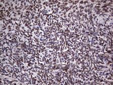 TLK2 Antibody - Immunohistochemical staining of paraffin-embedded Human Ovary tissue within the normal limits using anti-TLK2 mouse monoclonal antibody. (Heat-induced epitope retrieval by 1 mM EDTA in 10mM Tris, pH8.5, 120C for 3min,