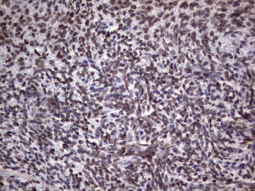 TLK2 Antibody - IHC of paraffin-embedded Human Ovary tissue using anti-TLK2 mouse monoclonal antibody. (Heat-induced epitope retrieval by 1 mM EDTA in 10mM Tris, pH8.5, 120°C for 3min).