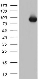 TLK2 Antibody - HEK293T cells were transfected with the pCMV6-ENTRY control (Left lane) or pCMV6-ENTRY TLK2 (Right lane) cDNA for 48 hrs and lysed. Equivalent amounts of cell lysates (5 ug per lane) were separated by SDS-PAGE and immunoblotted with anti-TLK2.
