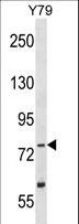 TLK2 Antibody - TLK2 Antibody (K155) western blot of Y79 cell line lysates (35 ug/lane). The TLK2 antibody detected the TLK2 protein (arrow).