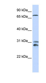 TLK2 Antibody - TLK2 antibody Western blot of 721_B cell lysate. This image was taken for the unconjugated form of this product. Other forms have not been tested.