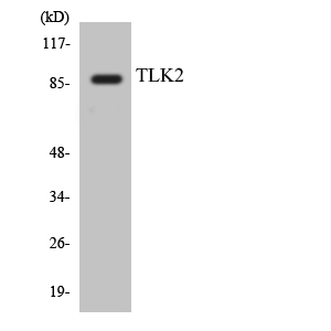 TLK2 Antibody - Western blot analysis of the lysates from HeLa cells using TLK2 antibody.