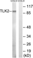 TLK2 Antibody - Western blot analysis of lysates from COLO cells, using TLK2 Antibody. The lane on the right is blocked with the synthesized peptide.