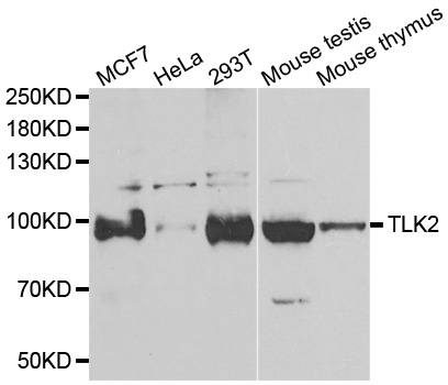 TLK2 Antibody - Western blot analysis of extracts of various cell lines.