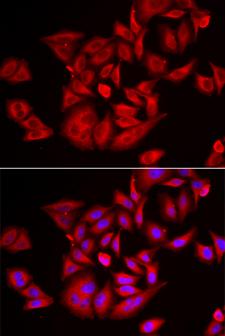 TLK2 Antibody - Immunofluorescence analysis of U2OS cells.