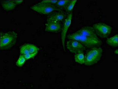 TLK2 Antibody - Immunofluorescent analysis of Hela cells diluted at 1:100 and Alexa Fluor 488-congugated AffiniPure Goat Anti-Rabbit IgG(H+L)