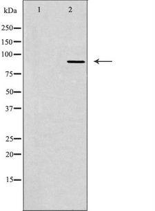 TLK2 Antibody - Western blot analysis of extracts of COLO cells using TLK2 antibody. The lane on the left is treated with the antigen-specific peptide.