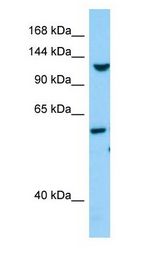TLL1 Antibody - TLL1 antibody Western Blot of Fetal Heart.  This image was taken for the unconjugated form of this product. Other forms have not been tested.