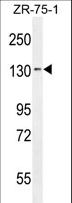 TLL1 Antibody - TLL1 Antibody western blot of ZR-75-1 cell line lysates (35 ug/lane). The TLL1 antibody detected the TLL1 protein (arrow).