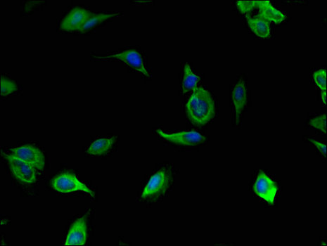 TLL1 Antibody - Immunofluorescent analysis of Hela cells using TLL1 Antibody at a dilution of 1:100 and Alexa Fluor 488-congugated AffiniPure Goat Anti-Rabbit IgG(H+L)
