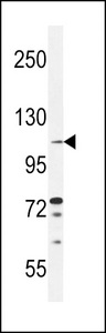 TLL2 Antibody - TLL2 Antibody western blot of ZR-75-1 cell line lysates (35 ug/lane). The TLL2 antibody detected the TLL2 protein (arrow).