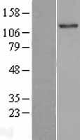 TLL2 Protein - Western validation with an anti-DDK antibody * L: Control HEK293 lysate R: Over-expression lysate