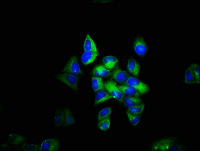 TLN1 / Talin 1 Antibody - Immunofluorescence staining of Hela cells with TLN1 Antibody at 1:133, counter-stained with DAPI. The cells were fixed in 4% formaldehyde, permeabilized using 0.2% Triton X-100 and blocked in 10% normal Goat Serum. The cells were then incubated with the antibody overnight at 4°C. The secondary antibody was Alexa Fluor 488-congugated AffiniPure Goat Anti-Rabbit IgG(H+L).