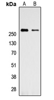 TLN1 / Talin 1 Antibody - Western blot analysis of Talin 1 expression in Jurkat (A); K562 (B) whole cell lysates.