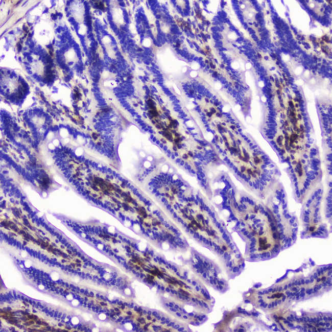 TLN1 / Talin 1 Antibody - IHC analysis of Talin 1 using anti-Talin 1 antibody. Talin 1 was detected in paraffin-embedded section of mouse small intestine tissue. Heat mediated antigen retrieval was performed in citrate buffer (pH6, epitope retrieval solution) for 20 mins. The tissue section was blocked with 10% goat serum. The tissue section was then incubated with 2?g/ml rabbit anti-Talin 1 Antibody overnight at 4?C. Biotinylated goat anti-rabbit IgG was used as secondary antibody and incubated for 30 minutes at 37?C. The tissue section was developed using Strepavidin-Biotin-Complex (SABC) with DAB as the chromogen.