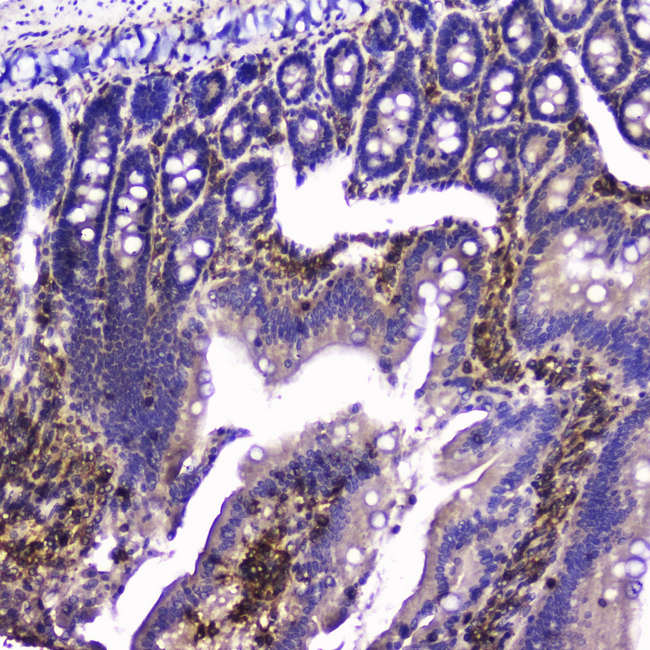 TLN1 / Talin 1 Antibody - IHC analysis of Talin 1 using anti-Talin 1 antibody. Talin 1 was detected in paraffin-embedded section of rat small intestine tissue. Heat mediated antigen retrieval was performed in citrate buffer (pH6, epitope retrieval solution) for 20 mins. The tissue section was blocked with 10% goat serum. The tissue section was then incubated with 2µg/ml rabbit anti-Talin 1 Antibody overnight at 4°C. Biotinylated goat anti-rabbit IgG was used as secondary antibody and incubated for 30 minutes at 37°C. The tissue section was developed using Strepavidin-Biotin-Complex (SABC) with DAB as the chromogen.