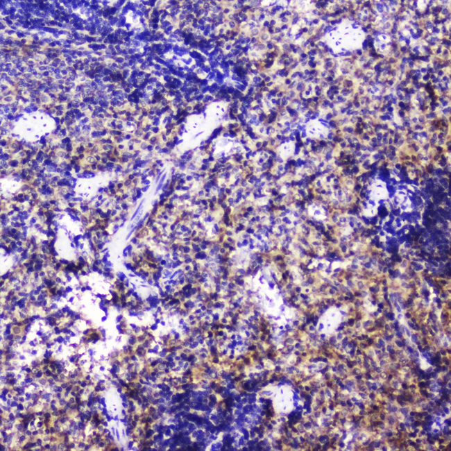 TLN1 / Talin 1 Antibody - IHC analysis of Talin 1 using anti-Talin 1 antibody. Talin 1 was detected in paraffin-embedded section of mouse spleen tissue . Heat mediated antigen retrieval was performed in citrate buffer (pH6, epitope retrieval solution) for 20 mins. The tissue section was blocked with 10% goat serum. The tissue section was then incubated with 2µg/ml rabbit anti-Talin 1 Antibody overnight at 4°C. Biotinylated goat anti-rabbit IgG was used as secondary antibody and incubated for 30 minutes at 37°C. The tissue section was developed using Strepavidin-Biotin-Complex (SABC) with DAB as the chromogen.