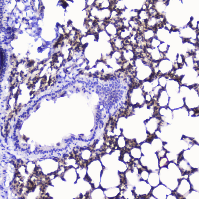 TLN1 / Talin 1 Antibody - IHC analysis of Talin 1 using anti-Talin 1 antibody. Talin 1 was detected in paraffin-embedded section of rat lung tissue . Heat mediated antigen retrieval was performed in citrate buffer (pH6, epitope retrieval solution) for 20 mins. The tissue section was blocked with 10% goat serum. The tissue section was then incubated with 2µg/ml rabbit anti-Talin 1 Antibody overnight at 4°C. Biotinylated goat anti-rabbit IgG was used as secondary antibody and incubated for 30 minutes at 37°C. The tissue section was developed using Strepavidin-Biotin-Complex (SABC) with DAB as the chromogen.