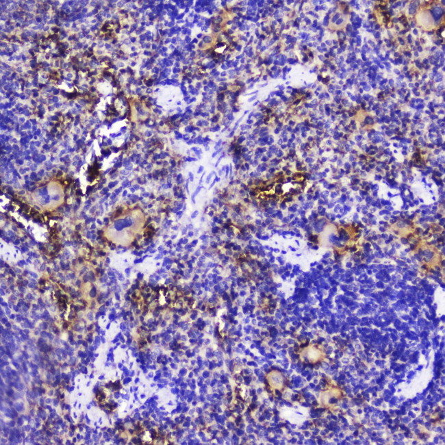 TLN1 / Talin 1 Antibody - IHC analysis of Talin 1 using anti-Talin 1 antibody. Talin 1 was detected in paraffin-embedded section of rat spleen tissue . Heat mediated antigen retrieval was performed in citrate buffer (pH6, epitope retrieval solution) for 20 mins. The tissue section was blocked with 10% goat serum. The tissue section was then incubated with 2µg/ml rabbit anti-Talin 1 Antibody overnight at 4°C. Biotinylated goat anti-rabbit IgG was used as secondary antibody and incubated for 30 minutes at 37°C. The tissue section was developed using Strepavidin-Biotin-Complex (SABC) with DAB as the chromogen.