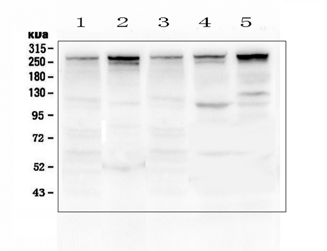 TLN1 / Talin 1 Antibody - Western blot analysis of Talin 1 using anti-Talin 1 antibody. Electrophoresis was performed on a 5-20% SDS-PAGE gel at 70V (Stacking gel) / 90V (Resolving gel) for 2-3 hours. The sample well of each lane was loaded with 50ug of sample under reducing conditions. Lane 1: rat lung tissue lysates, Lane 2: mouse lung tissue lysates, Lane 3: human U-87MG whole cell lysates,Lane 4: human MDA-MB-231 whole cell lysates,Lane 5: human HepG2 whole cell lysates. After Electrophoresis, proteins were transferred to a Nitrocellulose membrane at 150mA for 50-90 minutes. Blocked the membrane with 5% Non-fat Milk/ TBS for 1.5 hour at RT. The membrane was incubated with rabbit anti-Talin 1 antigen affinity purified polyclonal antibody at 0.5 ?g/mL overnight at 4?C, then washed with TBS-0.1% Tween 3 times with 5 minutes each and probed with a goat anti-rabbit IgG-HRP secondary antibody at a dilution of 1:10000 for 1.5 hour at RT. The signal is developed using an Enhanced Chemiluminescent detection (ECL) kit with Tanon 5200 system. A specific band was detected for Talin 1 at approximately 270KD. The expected band size for Talin 1 is at 270KD.