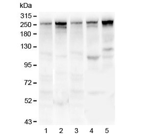 TLN1 / Talin 1 Antibody - Western blot testing of 1) rat lung, 2) mouse lung, 3) human U-87 MG, 4) human MDA-MB-231 and 5) human HepG2 lysate with Talin 1 antibody. Predicted molecular weight ~275 kDa.