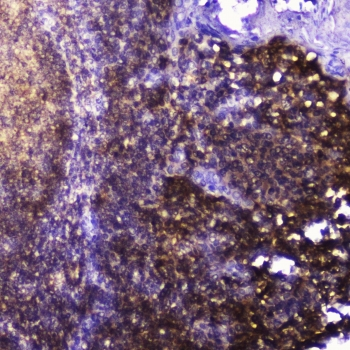 TLN1 / Talin 1 Antibody - IHC testing of FFPE human tonsil tissue with Talin 1 antibody at 2ug/ml. HIER: boil tissue sections in pH6, 10mM citrate buffer, for 10-20 min followed by cooling at RT for 20 min.