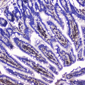 TLN1 / Talin 1 Antibody - IHC testing of FFPE mouse small intestine with Talin 1 antibody at 2ug/ml. HIER: boil tissue sections in pH6, 10mM citrate buffer, for 10-20 min followed by cooling at RT for 20 min.