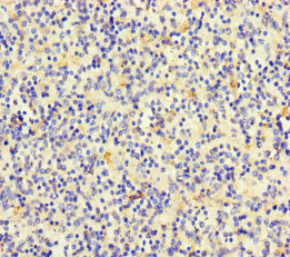 TLN2 / Talin 2 Antibody - Immunohistochemistry of paraffin-embedded human spleen tissue using TLN2 Antibody at dilution of 1:100