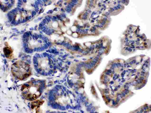 TLN2 / Talin 2 Antibody - Talin 2 was detected in paraffin-embedded sections of mouse intestine tissues using rabbit anti- Talin 2 Antigen Affinity purified polyclonal antibody