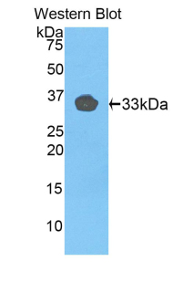 TLR1 Antibody - Western blot of recombinant TLR1.  This image was taken for the unconjugated form of this product. Other forms have not been tested.