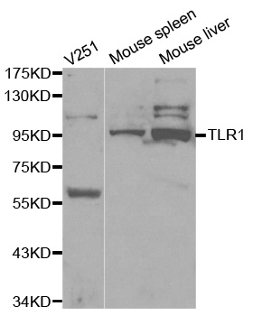 TLR1 Antibody - Western blot analysis of extracts of various cell lines.